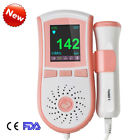 190891411433 Carejoy Baby Sound Fetal Doppler Heart Beat Monitor