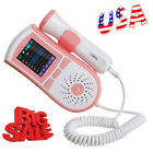 190891414687 Carejoy Pocket Fetal Doppler Prenatal Heart Baby Monitor