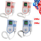 190891420121 Carejoy Usa Color Screen Fetal Dopler Babysound Prenatal