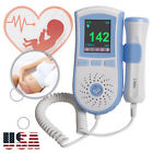 190891421692 Carejoy Us Lcd Display Fetal Doppler Prenatal Heart