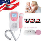 190891528476 Carejoy Usa Fetal Heart