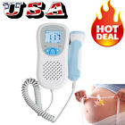 190891545107 Carejoy Prenatal Fetal Doppler
