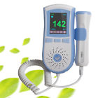 190891575999 Carejoy Us Fast Fetal Doppler Color Lcd Baby