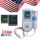 190891590527 Carejoy Color Pocket Fetal Dopple Prenatal Heart Monitor