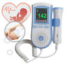 190891637697 Carejoy Portable Fetal Doppler Pocket Prenatal Heart Rate