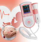 190891645760 Carejoy Usa Super Pocket Fetal Doppler Big Color 190891645760 Carejoy Usa Super Pocket Fetal Doppler Big Color