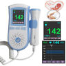 190891905598 Unbranded Function Fetal Doppler Prenatal Fetus Heart Waveform