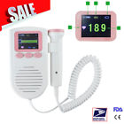 190891947734 Carejoy 2mhz Probe Baby