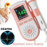 190891993489 Unbranded Sale Heart Wave Portable Fetal Doppler Oled