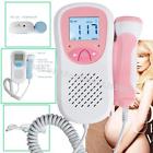 190891998781 Carejoy Pink Fetal Doppler