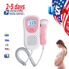 300063 Carejoy Us Fetal Doppler 190891802019