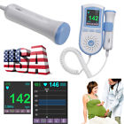 300072 Carejoy Color Lcd Pocket Fetal Doppler Prenatal Baby Heart Monitor 300072 Carejoy Color Lcd Pocket Fetal Doppler Prenatal Baby Heart Monitor