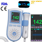 668801020180321501 Carejoy Color Lcd Pocket Fetal Doppler Prenatal Heart 190891681997