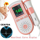 668801020180404678 Carejoy Us Fetal Doppler Baby Sound Color Monitor 190891659651