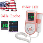 668815620180524005 Carejoy Color Pocket Fetal Dopple Prenatal Heart Monitor 190891531599