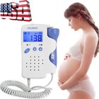 668815620180601004 Carejoy Fetal Doppler Lcd Display Baby Heart Beat 190891515810