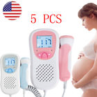 668815620180601007 Carejoy Fetal Heart Rate Doppler Lcd Pocket Prenatal 190891512468
