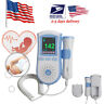 668817420170227755 Carejoy Fetal Doppler Prenatal Meter Baby Heart Rate 190891099464