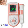 66881742017031167 Carejoy Pocket Fetal Doppler Prenatal Baby Heart Rate 190891704900