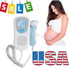 6688317201709012009 Carejoy Usa Prenatal Fetal 190891058577