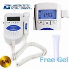 791658554648 Unbranded-generic Lcd Pocket Fetal 791658554648 Unbranded-generic Lcd Pocket Fetal
