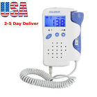 Bk207 Sunshine Ce Pregnancy Baby Fetus Heart Rate Monitor Fetal Doppler