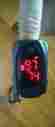 Md300c61 Choicemmed Pulse Spo2 Oxygen Oximeter