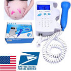 Xeda300044a Care Us Best Fetal 190891903006
