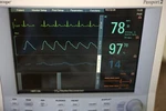 Datascope Passport - Ecg, Masimo SP02, Nibp, ETCO2, Color Screen, Printer. Fixed Price $1250.00.
