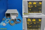 Ge 120 Series Model 0129 Maternal Fetal Monitor W/ Us & Toco Transducers 34006. Fixed Price $614.99.