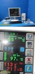 Spacelabs 91387 Ultraview Cpu W/ CDA19T Monitor, CO2/COMM Modules & Leads 36338. Fixed Price $675.99.