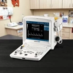 Edan Dus 60 Compact Portable Pw Doppler Ultrasound + Linear Convex Transducer. Fixed Price $6750.00.