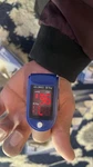Roscoe Medical Pox-ros Fingertip Pulse Oximeter. Fixed Price $5.00.